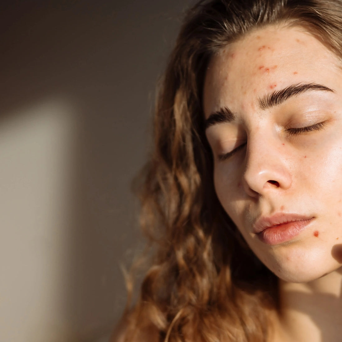 Pelle lucida e pori dilatati? Scopri la skincare riequilibrante